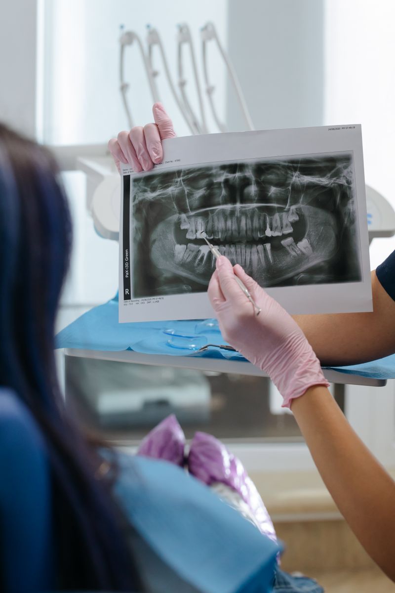 Bone Grafting