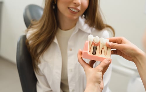Close-up view of dental implant components and healthy smile results